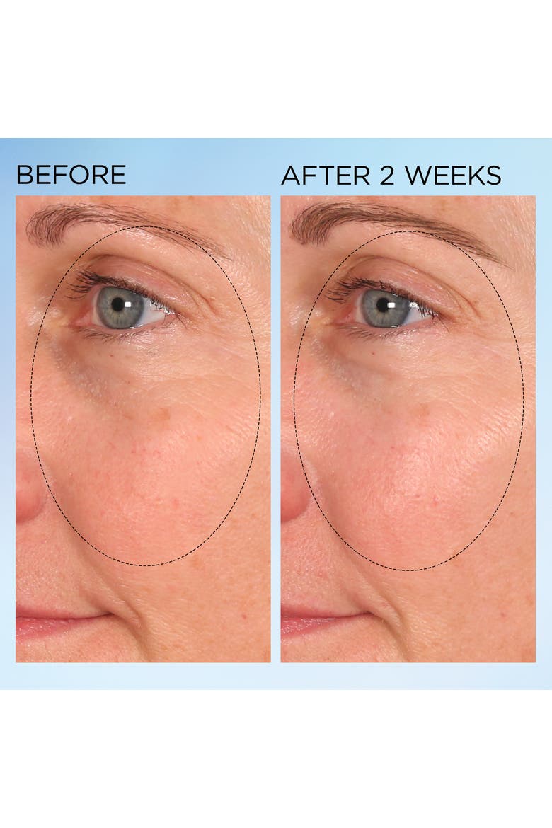 Visible Brightening Clearly Radiant Spot Correcting Capsules, Alternate, color, 60ct