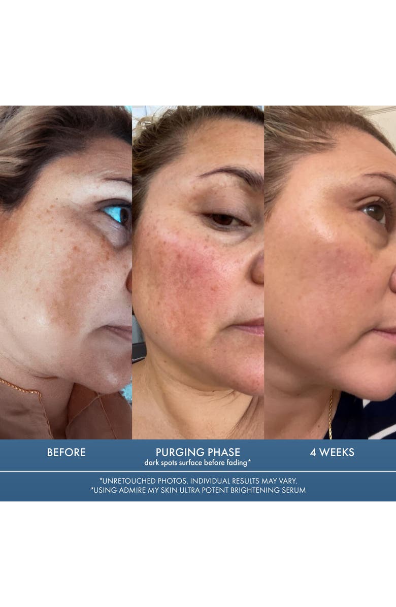 Admire My Skin Ultra Potent Brightening Serum Dark Spot Corrector, Alternate, color, Clear