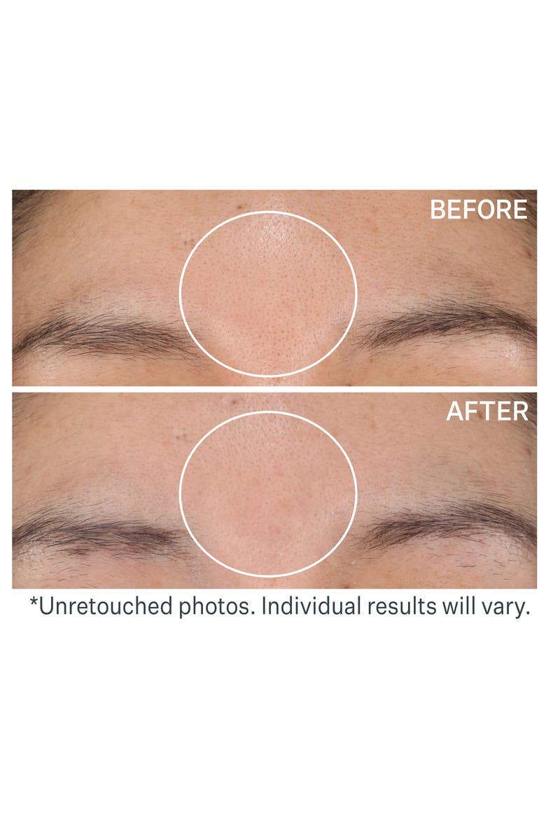 Daily Reveal™ Exfoliating Pads, Alternate, color, NO COLOR