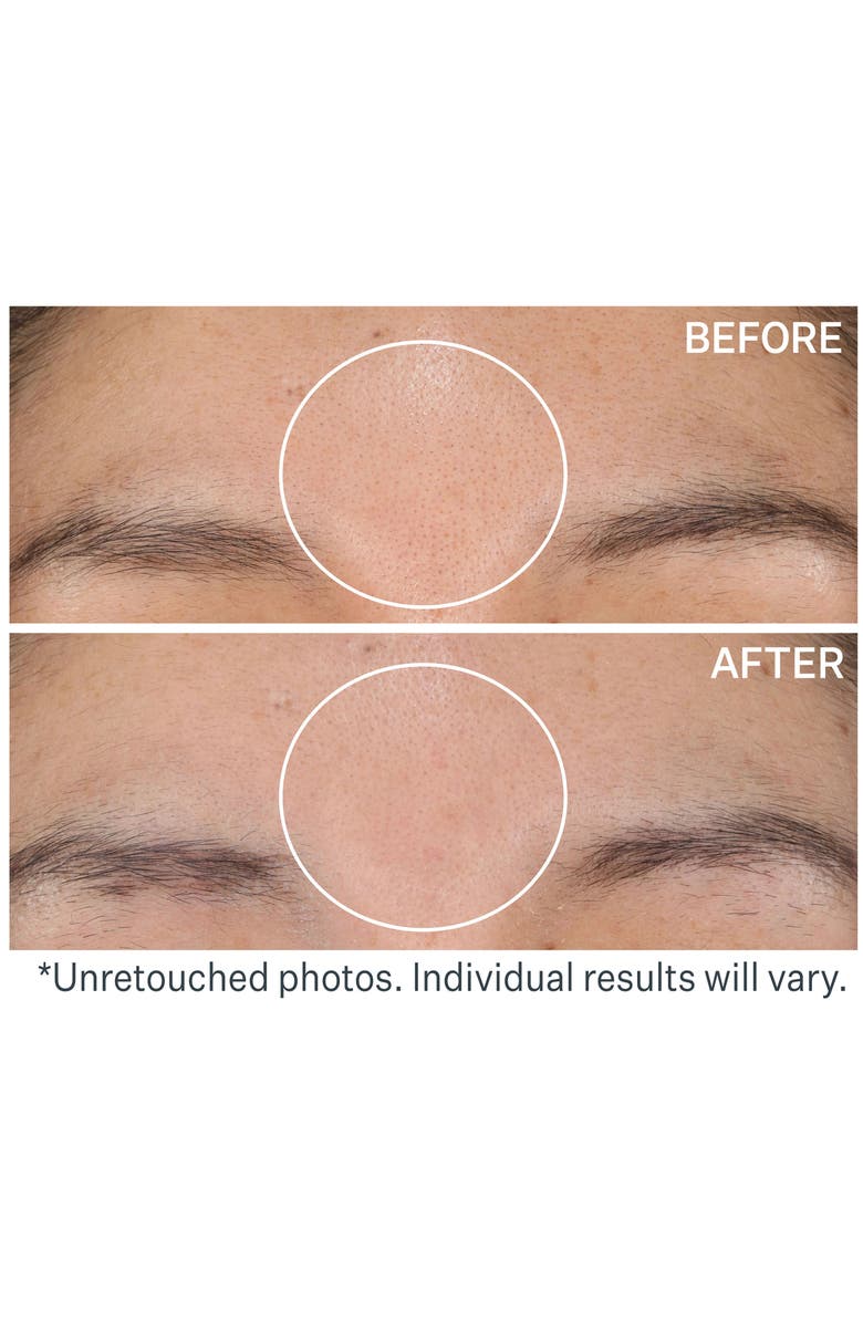 StriVectin<sup>®</sup> Daily Reveal<sup>™</sup> Exfoliating Pads, Alternate, color,