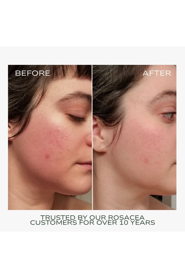 Redness Rescue Cream, Alternate, color, No Color