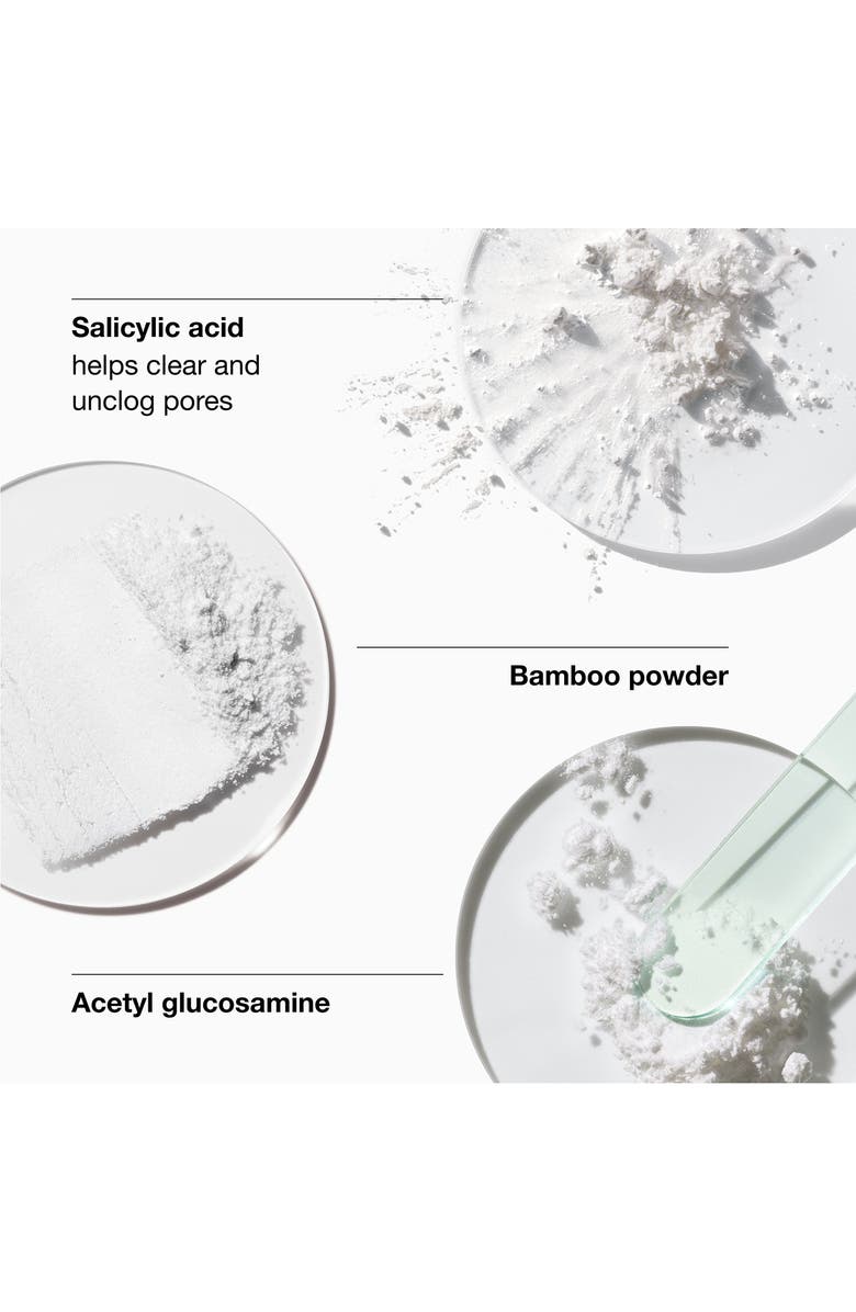 Clinique Blackhead Solutions Self-Heating Blackhead Extractor, Alternate, color, 