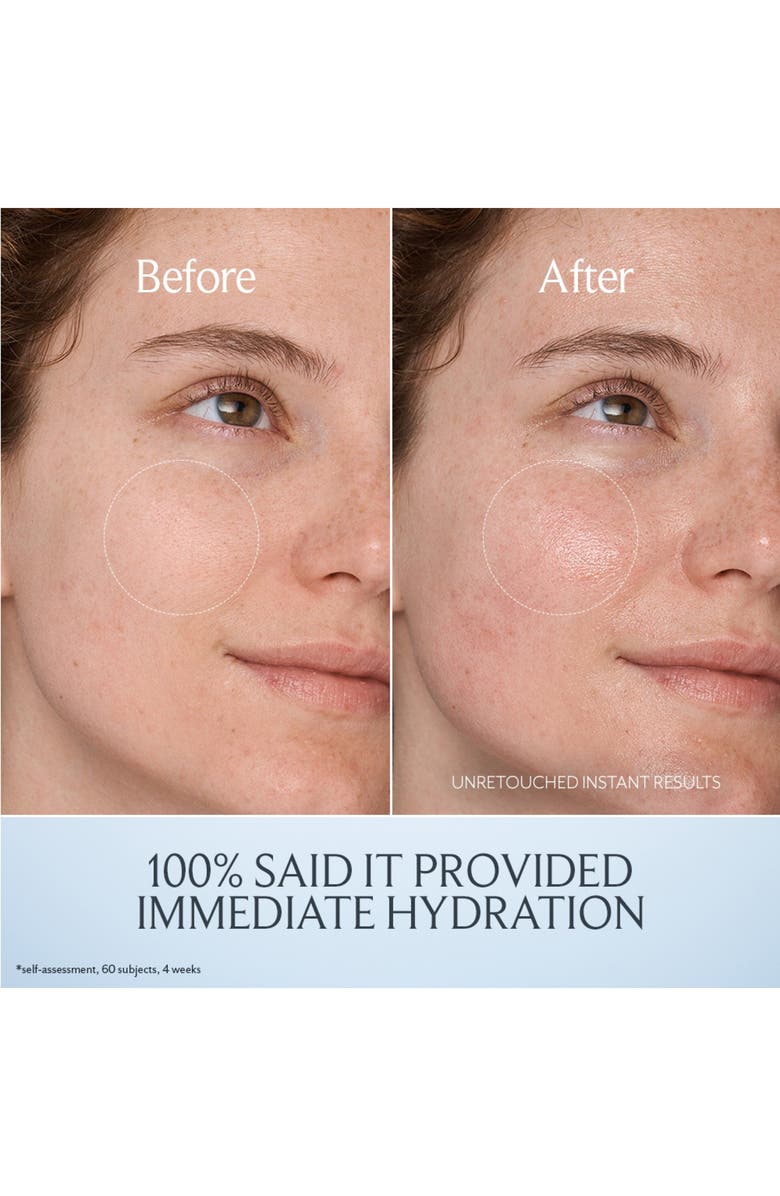 Fresh<sup>®</sup> Kombucha Antioxidant Facial Treatment Essence, Alternate, color,