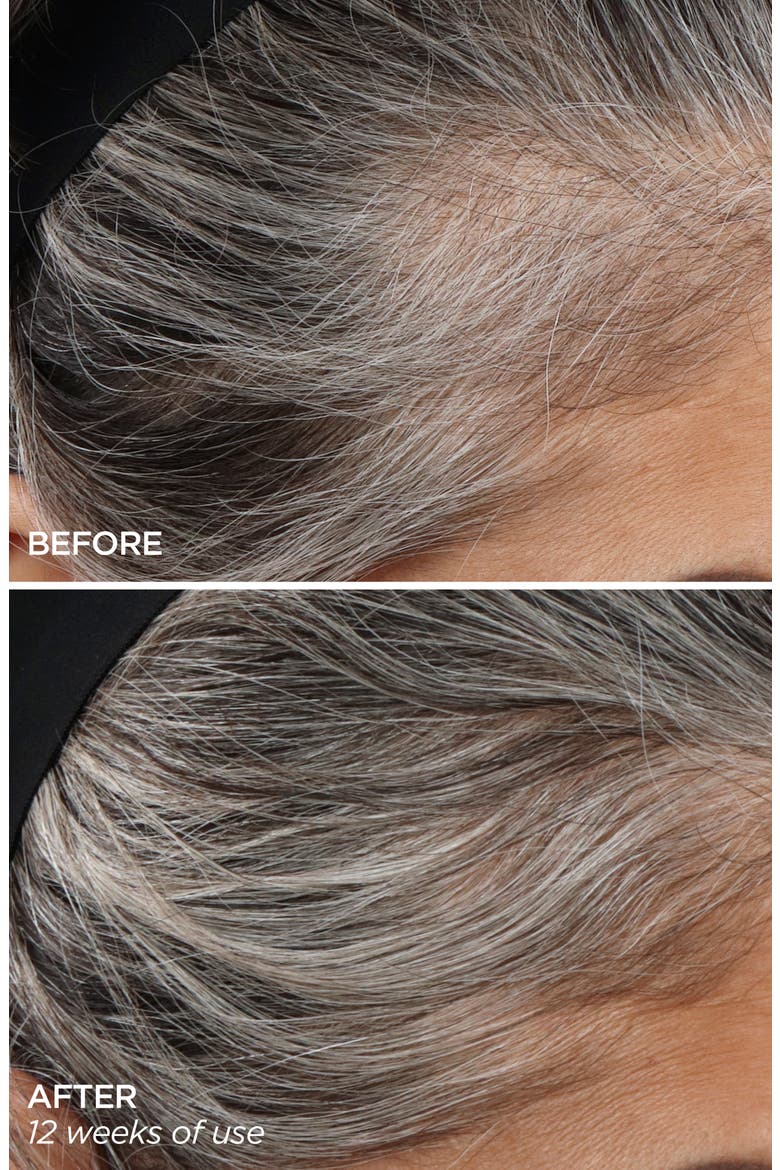 GloPRO® Rejuvenating Scalp + Fuller Hair Therapy Set, Alternate, color, NO COLOR