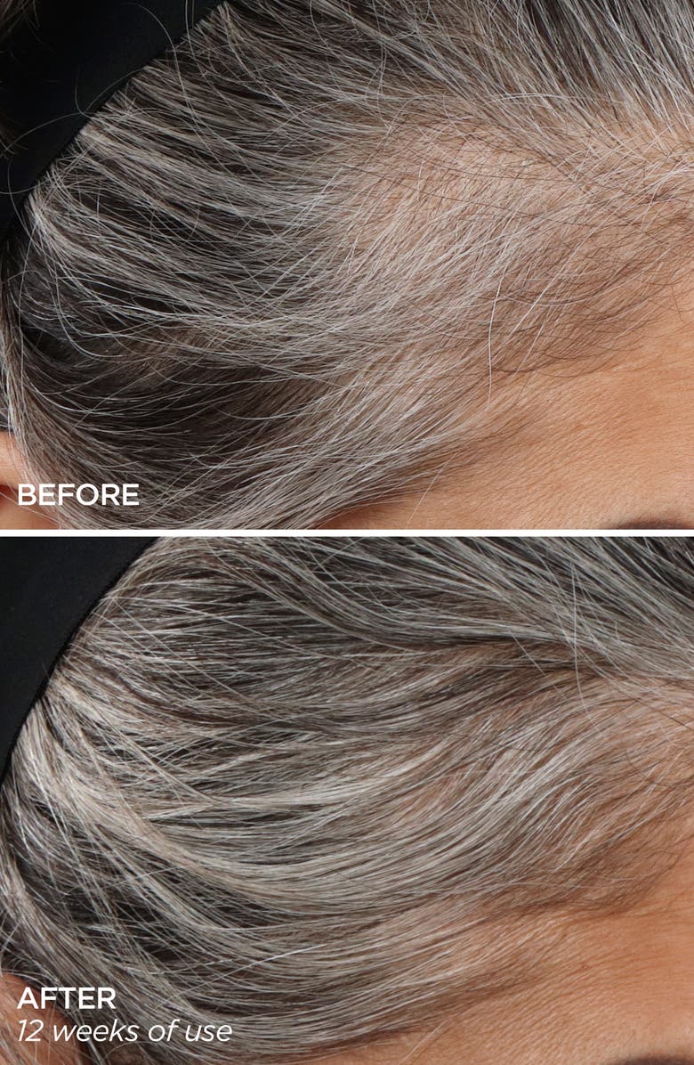 BeautyBio GloPRO<sup>®</sup> Rejuvenating Scalp + Fuller Hair Therapy Set, Alternate, color,