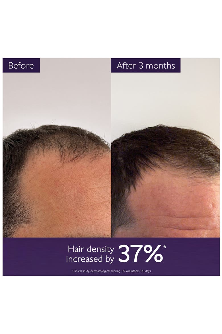 Hair Density Serum, Alternate, color, NO COLOR