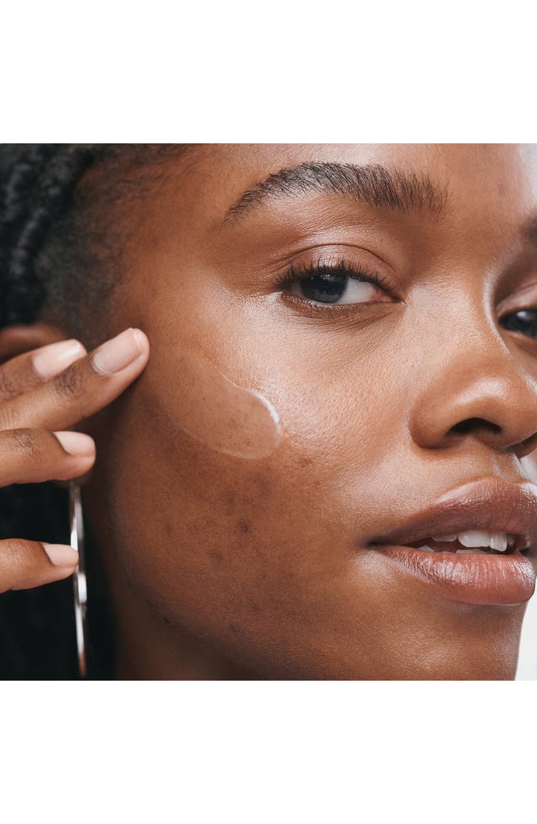 Clinique Even Better Clinical<sup>™</sup> Radical Dark Spot Corrector + Interrupter Serum, Alternate, color,