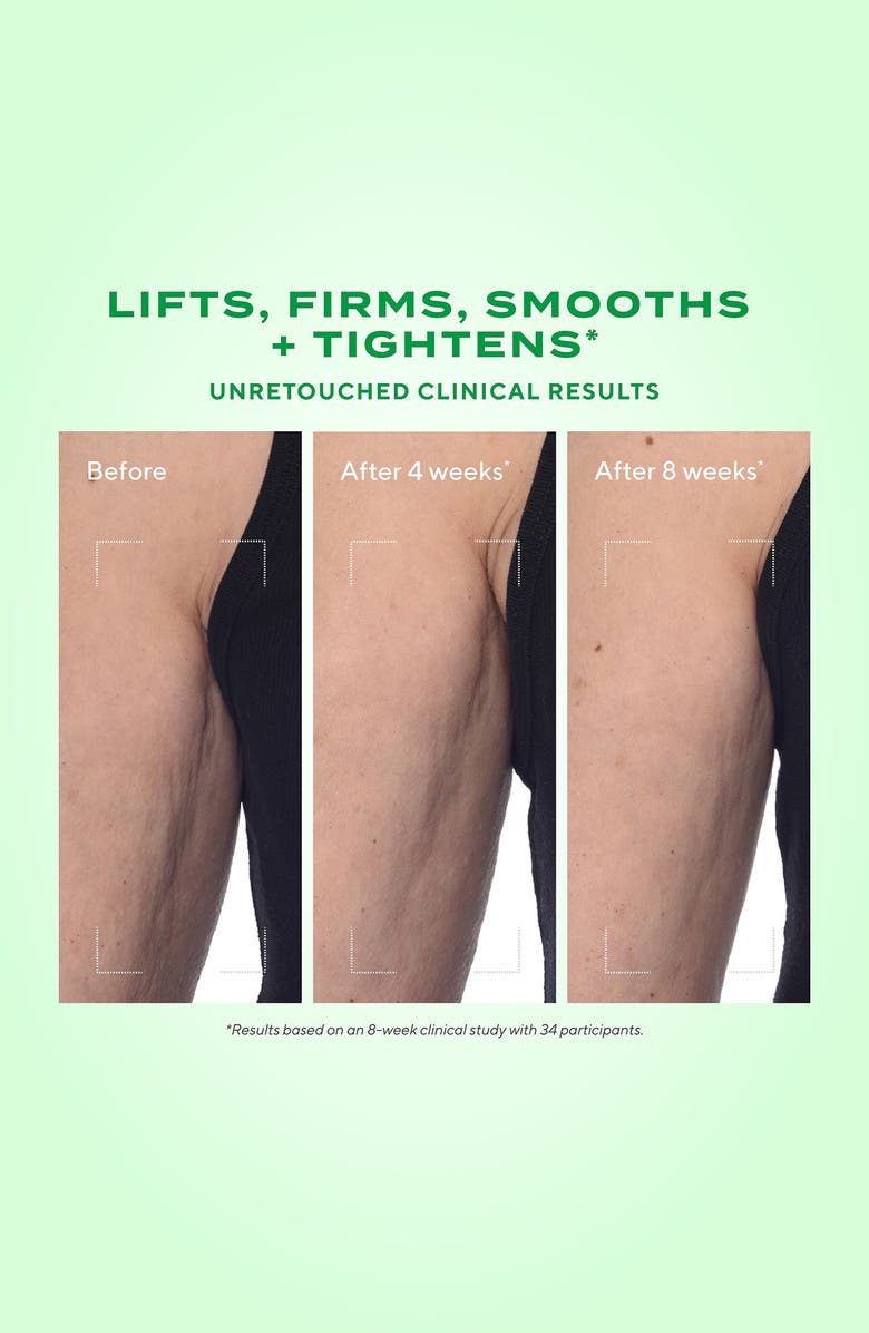 Murad<sup>®</sup> Retinal ReSculpt Body Treatment, Alternate, color, 