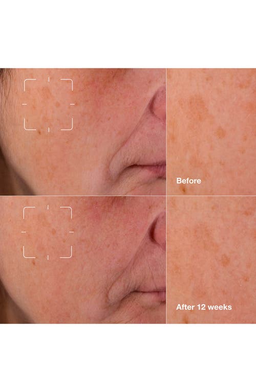 Clinique Even Better Clinical™ Dark Spot Clearing Serum In No Color