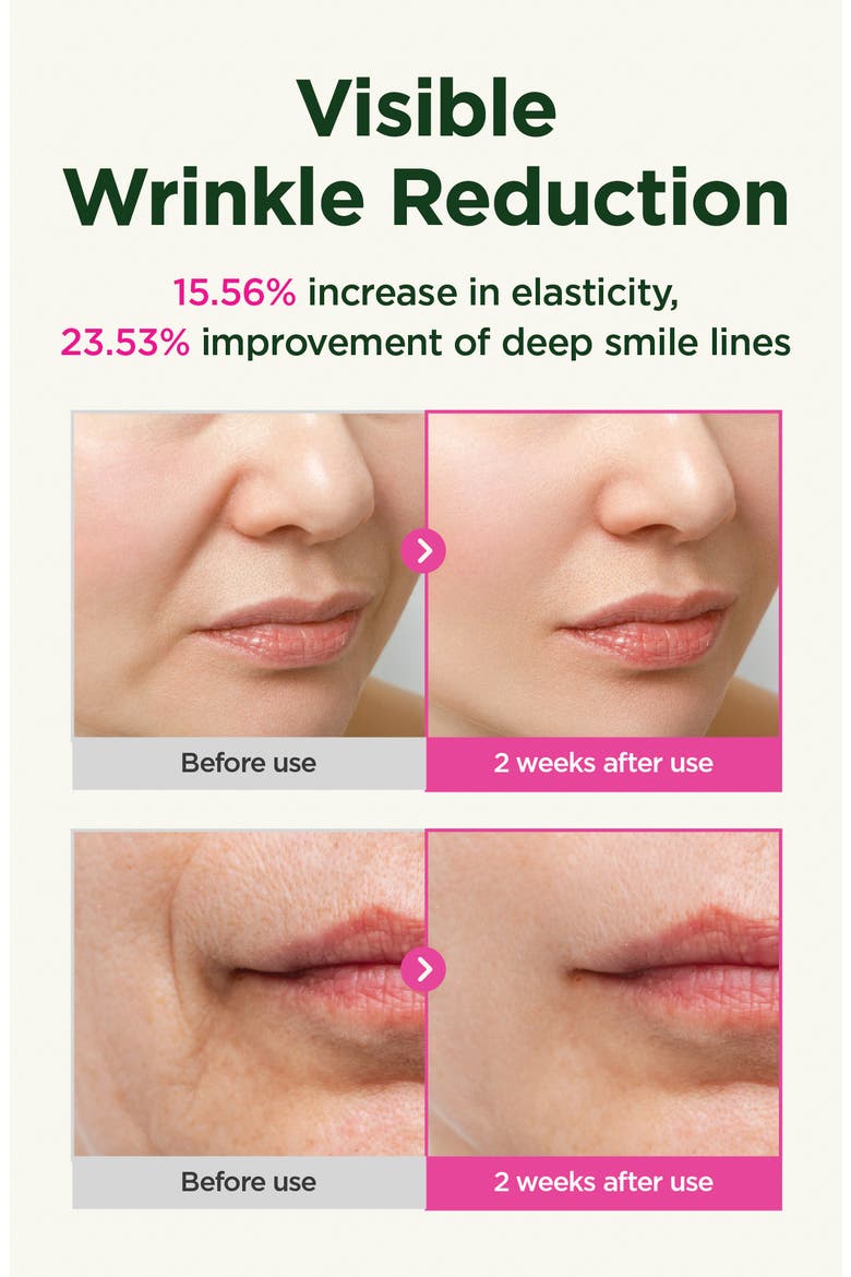 Retino Collagen Guasha Lifting Serum Flexible Liposome 300, Alternate, color, NO COLOR