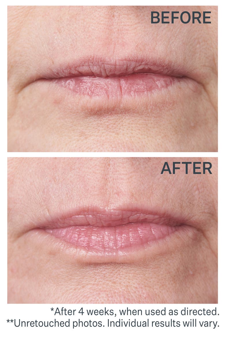 Doublefix™ for Lips Plumping & Vertical Line Treatment, Alternate, color, NO COLOR