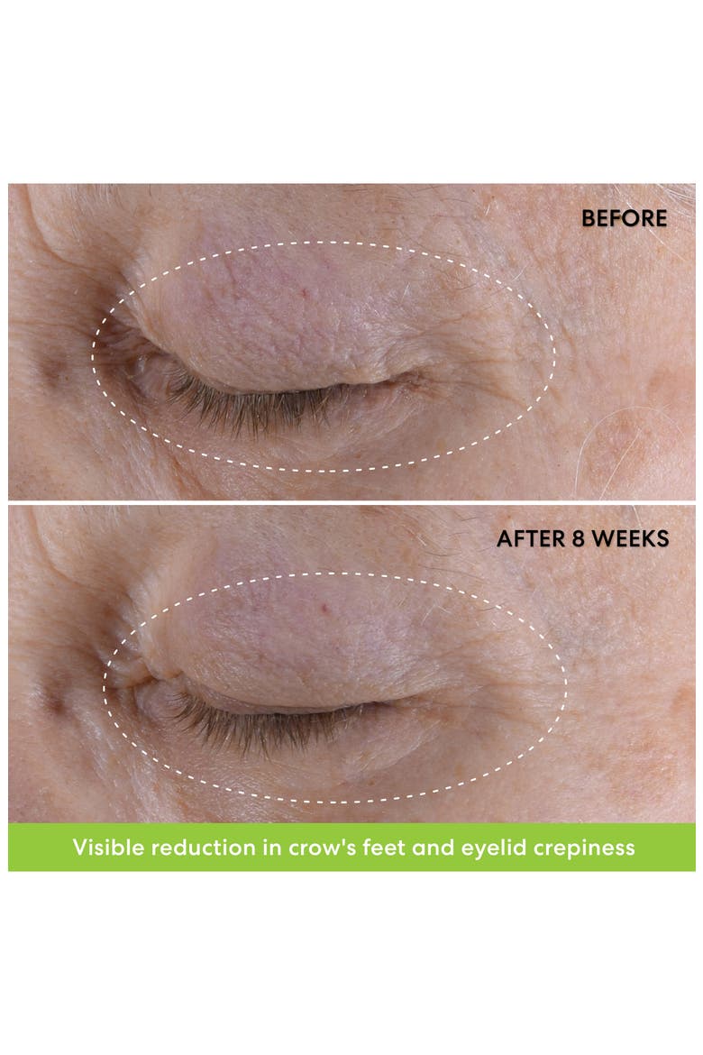 Ageless Phyto-Retinol Eye Cream, Alternate, color, NO COLOR