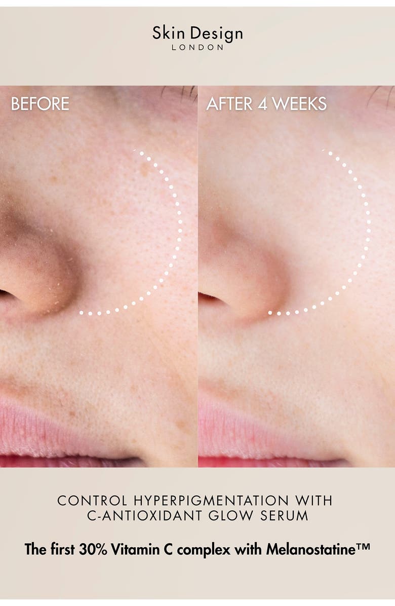 Skin Design London Antioxidant Glow Vitamin C Serum, Alternate, color,