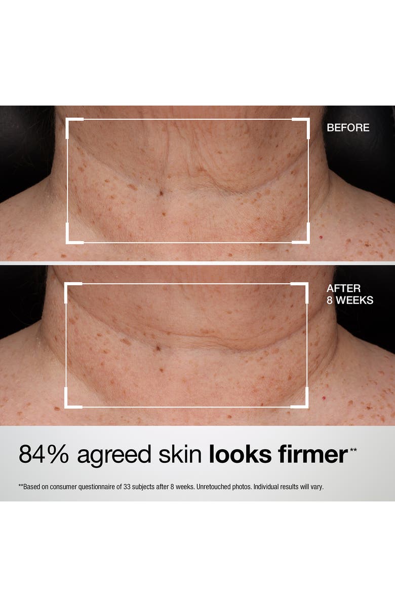 StriVectin<sup>®</sup> TL Advanced<sup>®</sup> Tightening Neck & Chest Lotion Broad Spectrum SPF 35 Sunscreen, Alternate, color, 