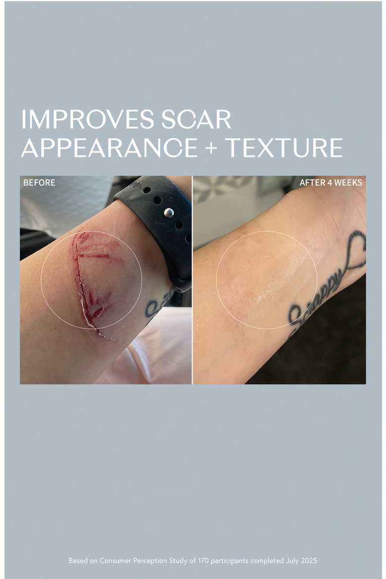 DNA Repair Complex for Redness & Scars, Alternate, color, None