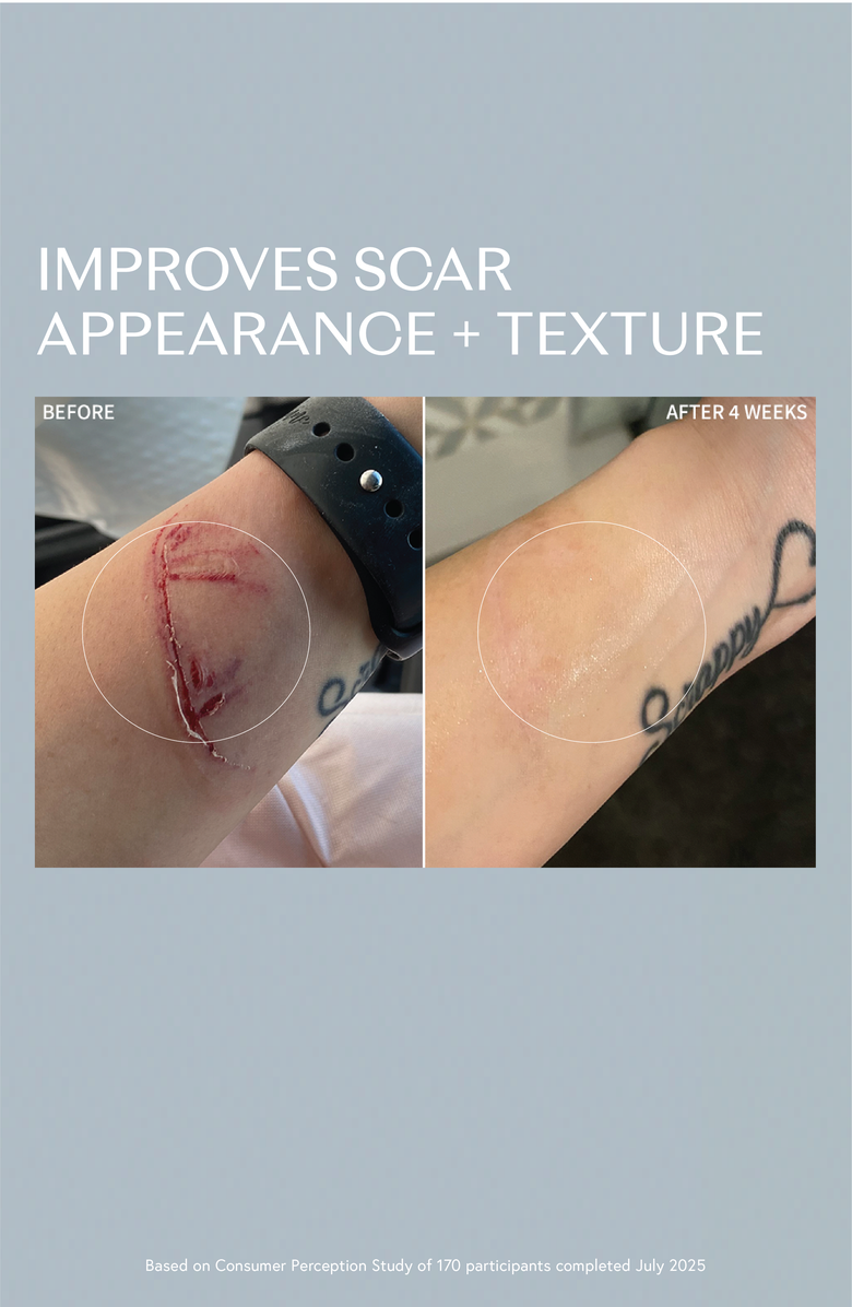 RescueMD DNA Repair Complex for Redness & Scars, Alternate, color, NO COLOR