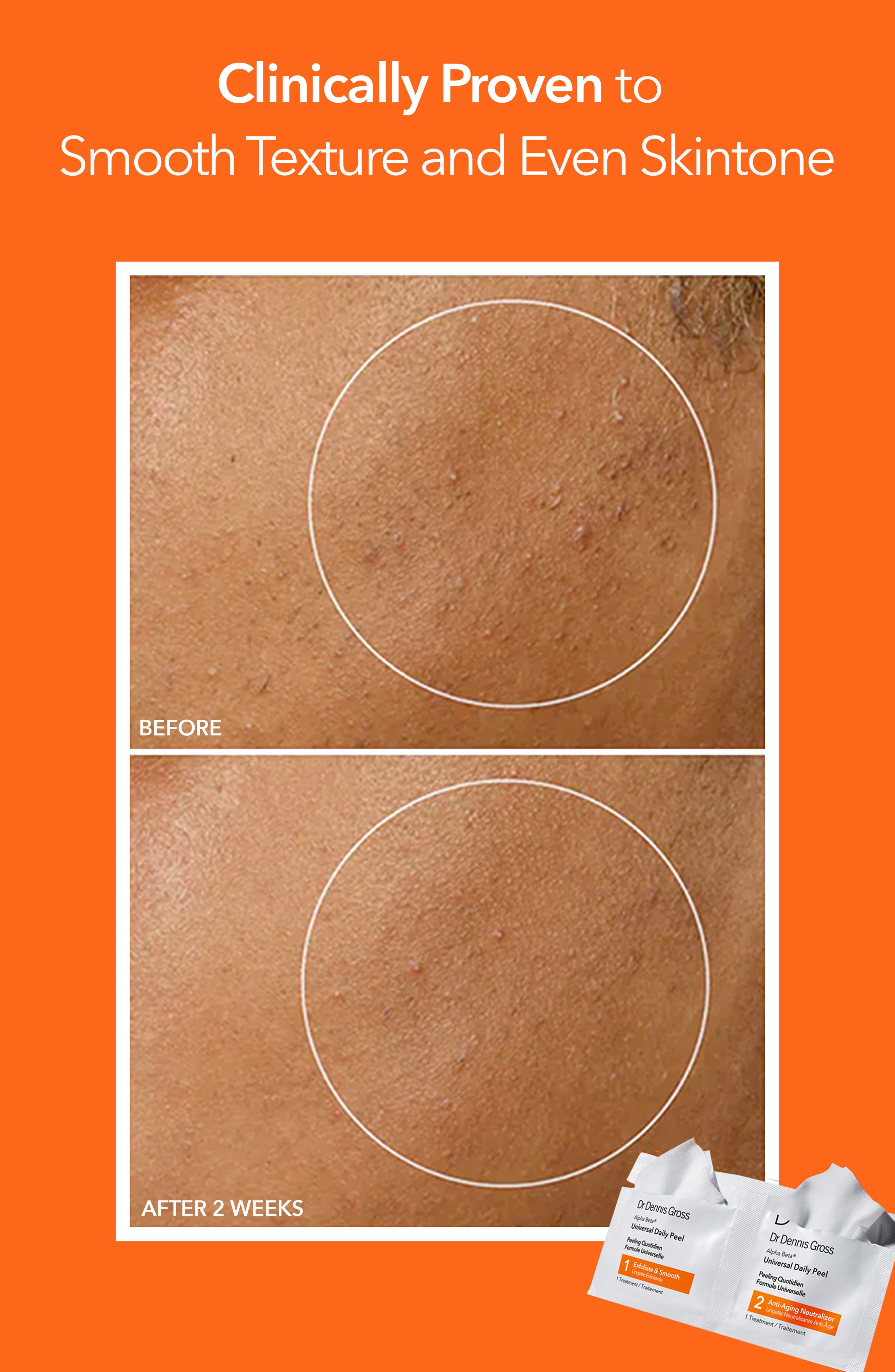 Dr. Dennis Gross Skincare Пилинг для лица Dr. Dennis Gross Alpha Beta Peel Original Formula — фото 4