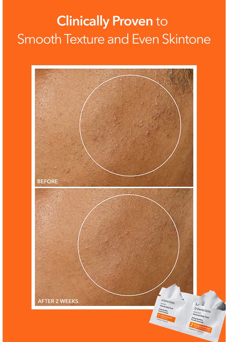 Alpha Beta® Peel Original Formula, Alternate, color, NO COLOR
