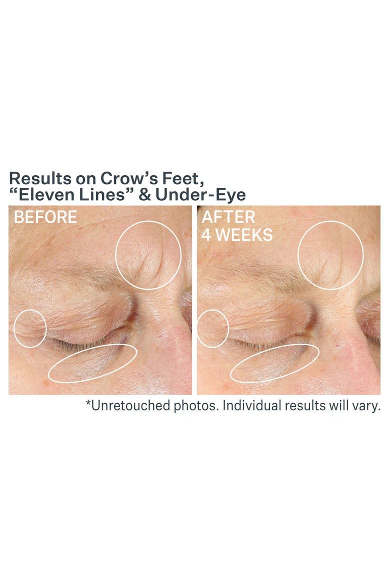 Anti-Wrinkle Intensive Eye Concentrate+, Alternate, color, NO COLOR