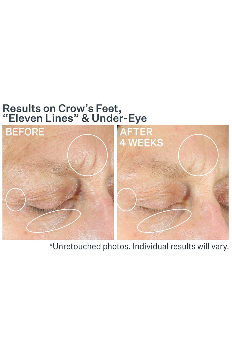 StriVectin<sup>®</sup> Anti-Wrinkle Intensive Eye Concentrate+, Alternate, color, 