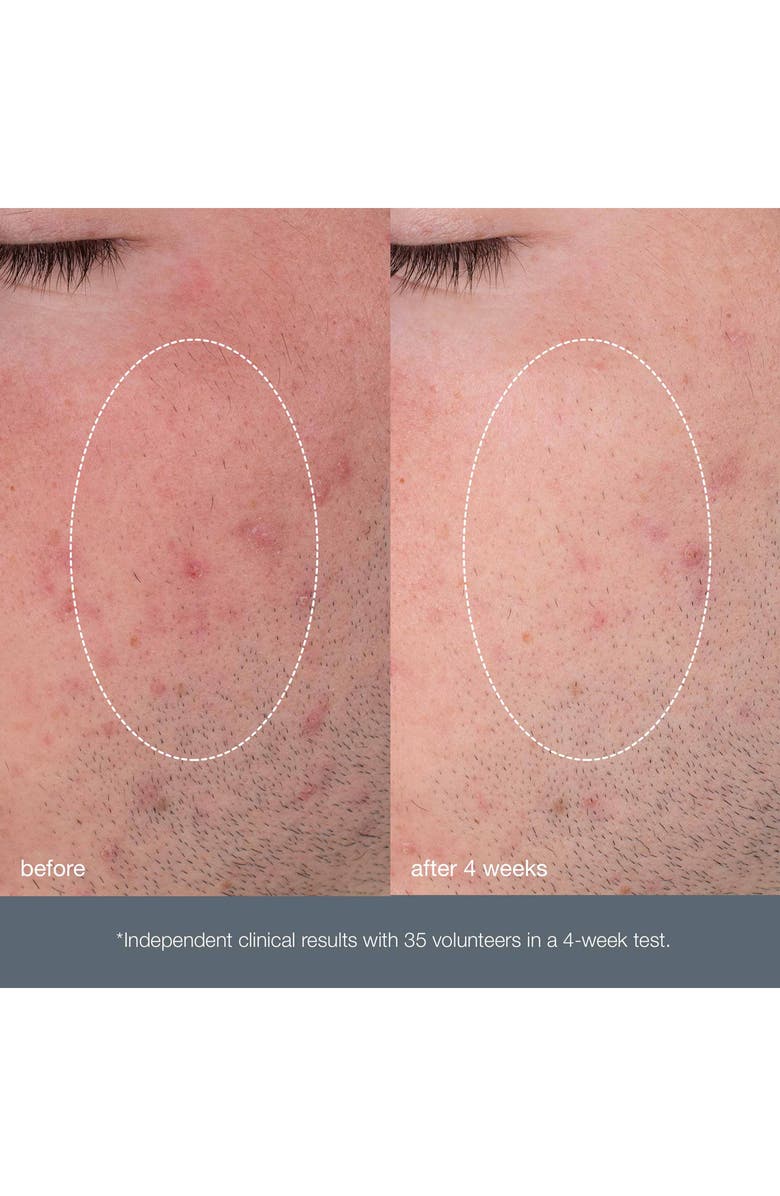 dermalogica<sup>®</sup> Daily Microfoliant<sup>®</sup> Exfoliator, Alternate, color,