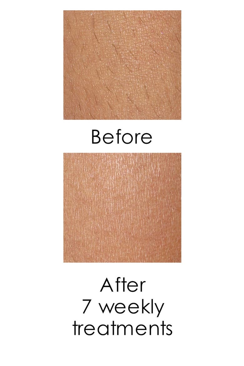 smooth Hair Removal Device, Alternate, color, NO COLOR
