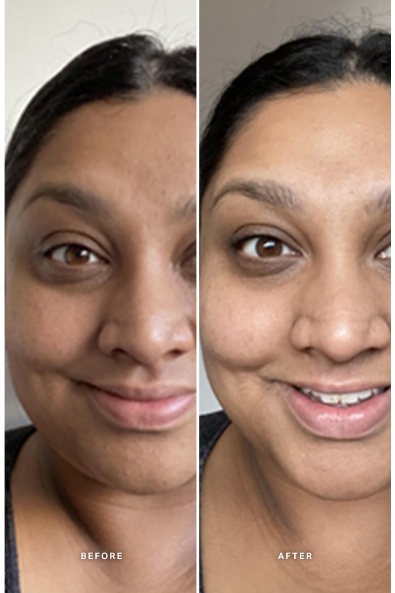 Liquid Gold™ Exfoliating Treatment with Glycolic Acid, Alternate, color, NO COLOR