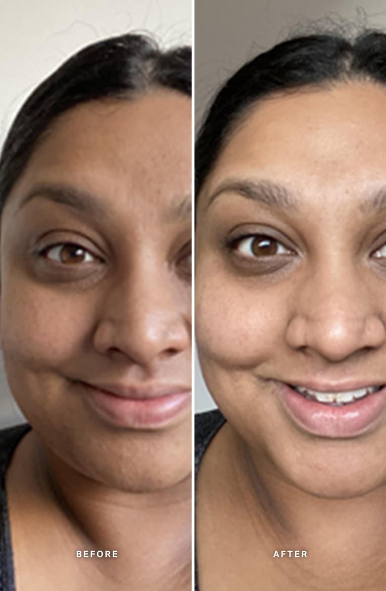 Alpha-H Liquid Gold<sup>™</sup> Exfoliating Treatment with Glycolic Acid, Alternate, color, 