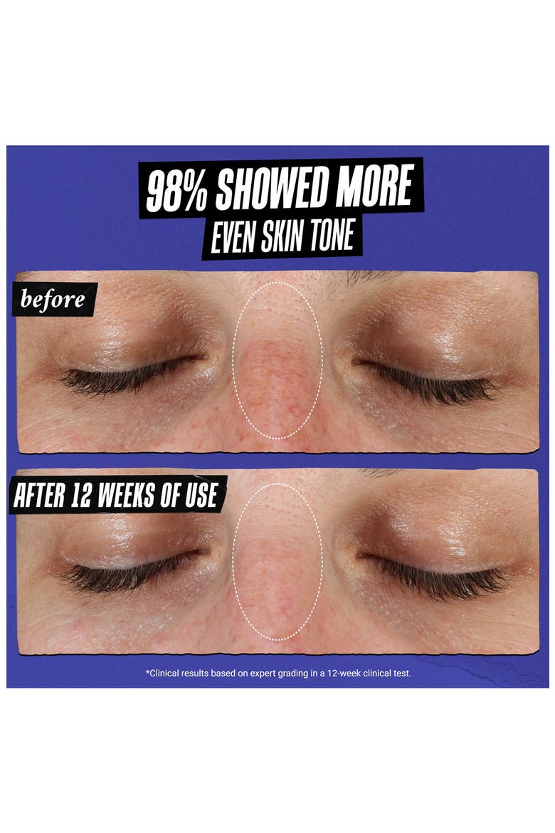 Clearly Corrective™ Dark Spot Solution Face Serum, Alternate, color, NO COLOR