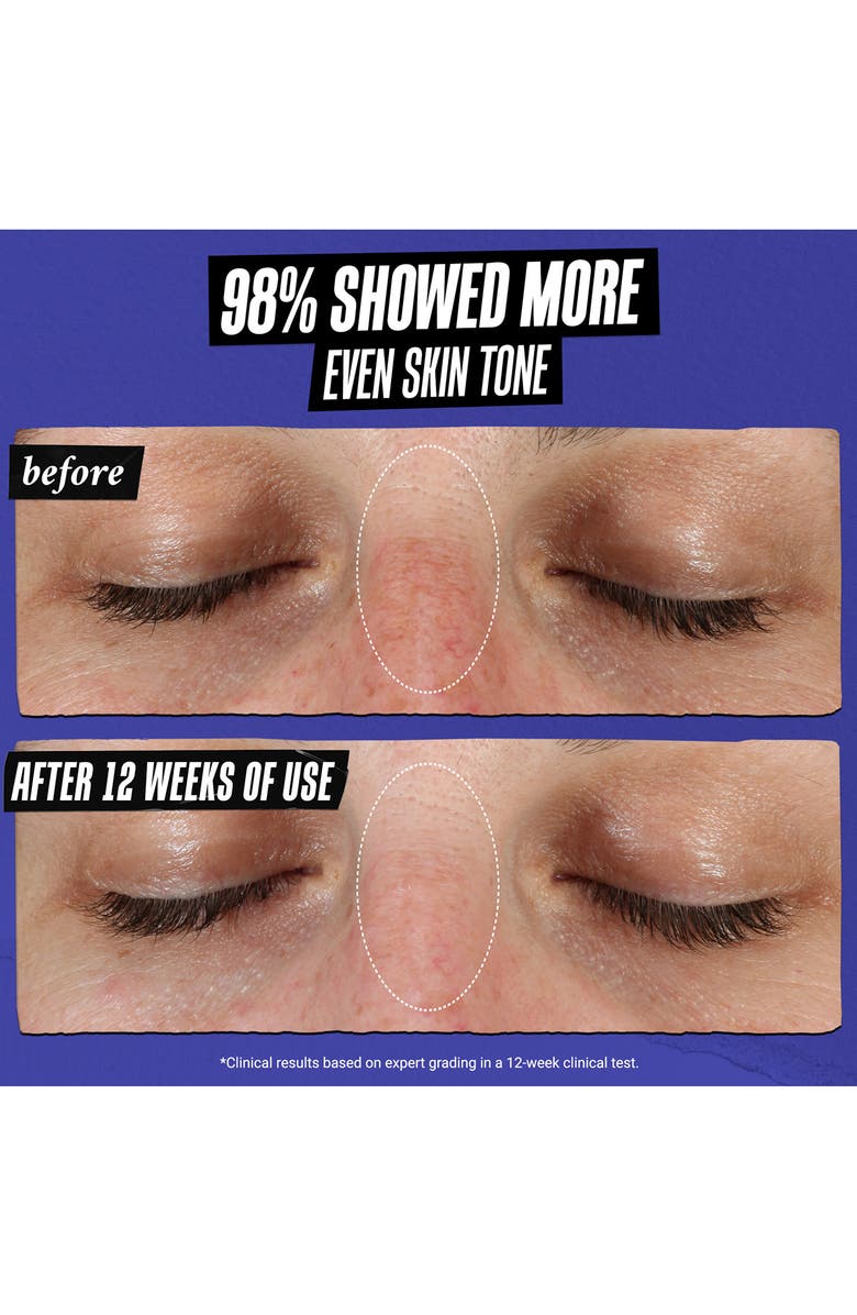 Kiehl's Since 1851 Clearly Corrective<sup>™</sup> Dark Spot Solution Face Serum, Alternate, color,