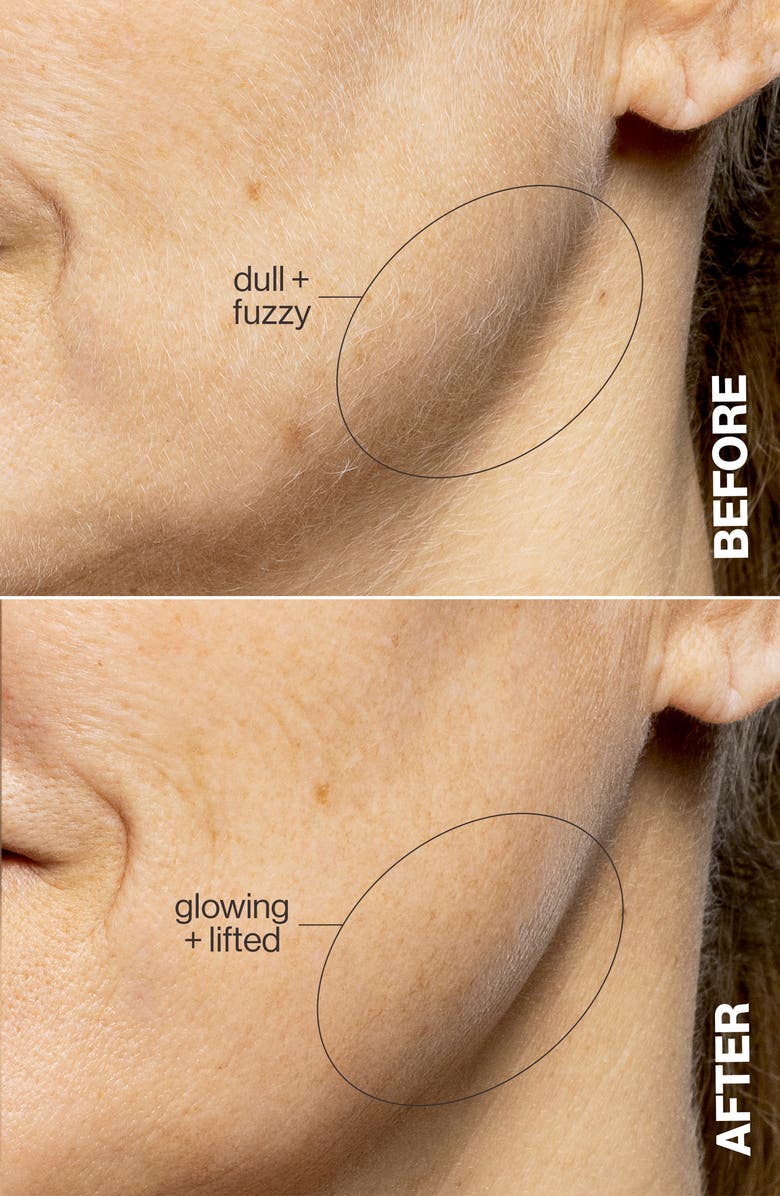 LUXE+ Advanced Sonic Dermaplaning & Peach Fuzz Removal Set