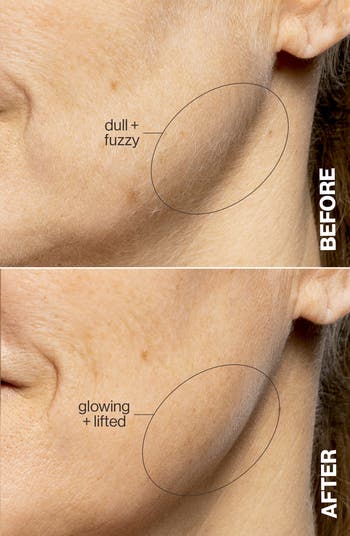 LUXE+ Advanced Sonic Dermaplaning & Peach Fuzz Removal Set