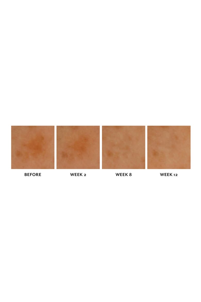 PowerPatch Dark Spot Corrector, Alternate, color, NO COLOR