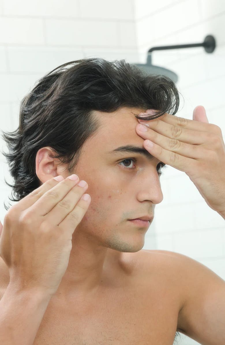 TIEGE HANLEY Acne Serum, Alternate, color, 