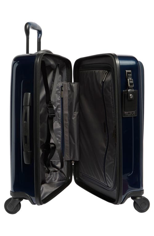 Tumi Dfo V4 21-inch Expandable Softside Spinner Carry-on