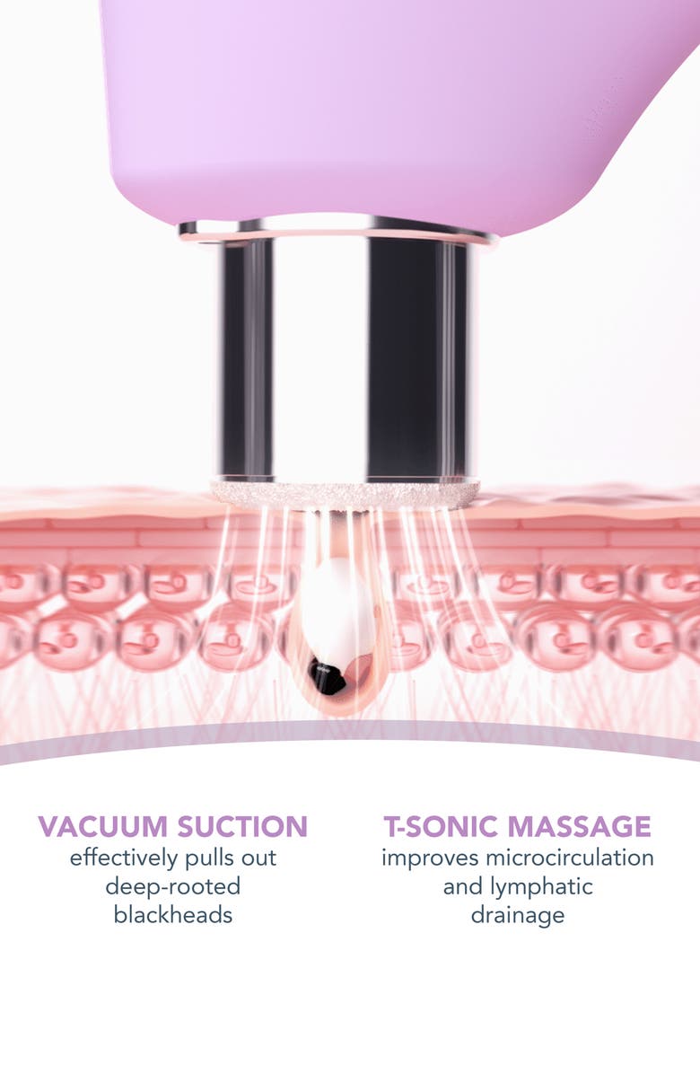 FOREO KIWI Derma Diamond Microdermabrasion & Pore Vacuum, Alternate, color,