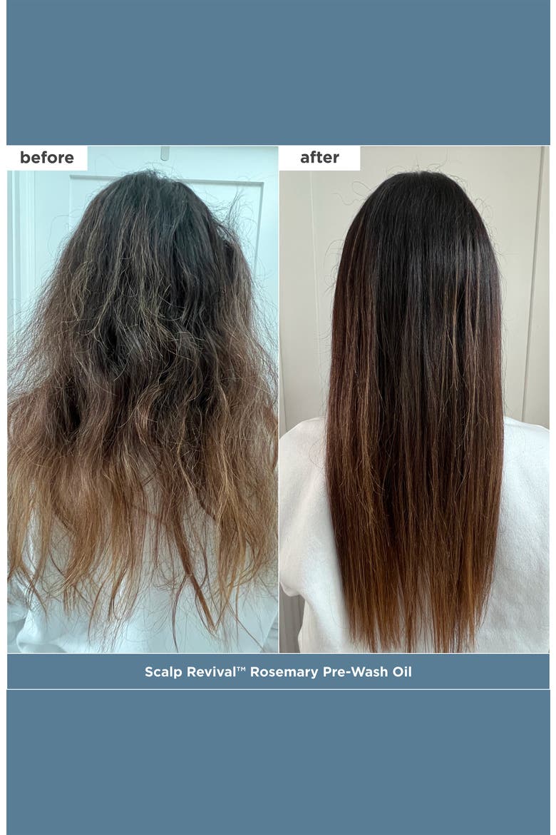 Scalp Revival™ + Don't Despair, Repair!™ Healthy Hair Delights Set, Alternate, color, NO COLOR
