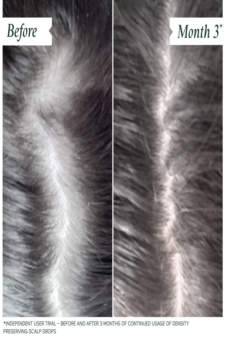 Density Preserving Scalp Drops, Alternate, color, NO COLOR