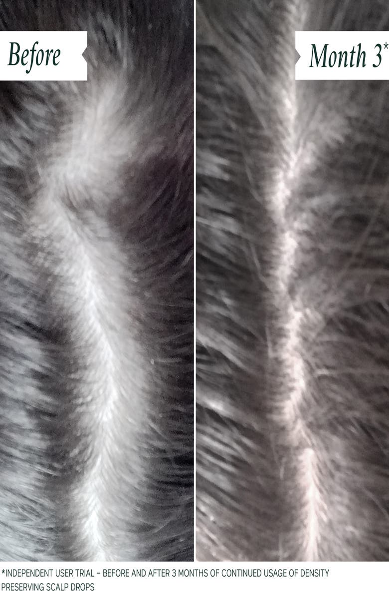 Philip Kingsley Density Preserving Scalp Drops, Alternate, color, 