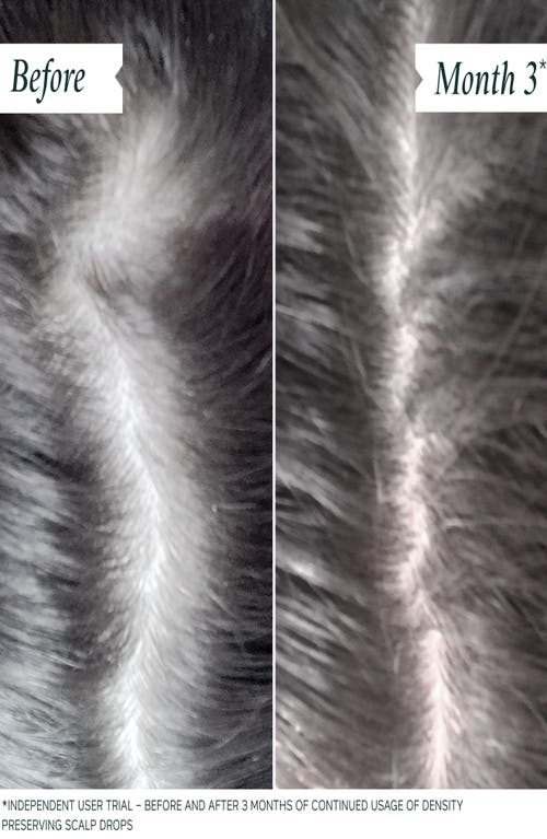 Philip Kingsley Density Preserving Scalp Drops