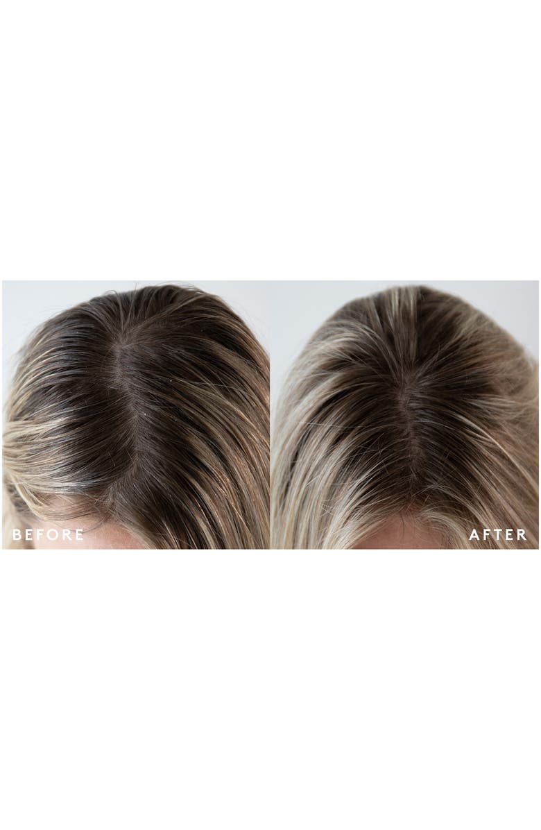 Virtue<sup>®</sup> Refresh Topical Scalp Supplement, Alternate, color, 