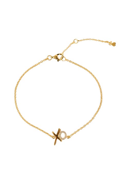 Xo Charm Bracelet