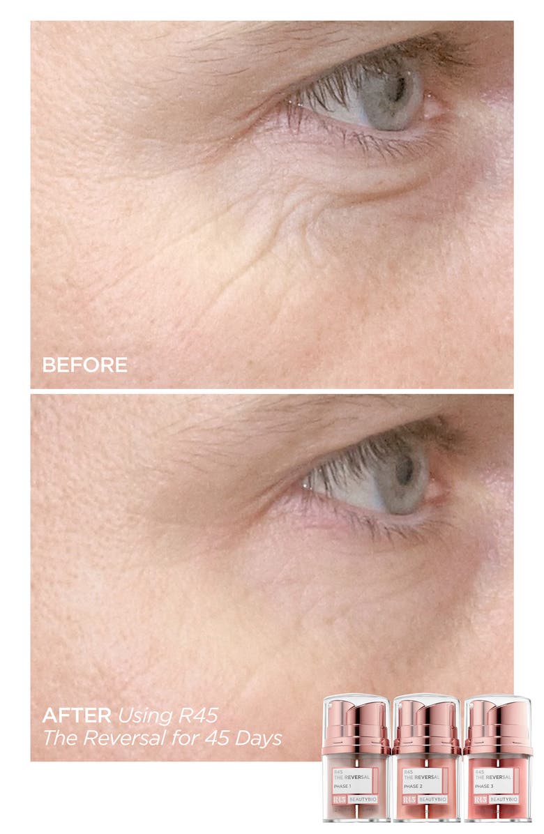 BeautyBio Full Size R45 The Reversal 3-Phase Skin Transforming Treatment Set $235 Value, Alternate, color,