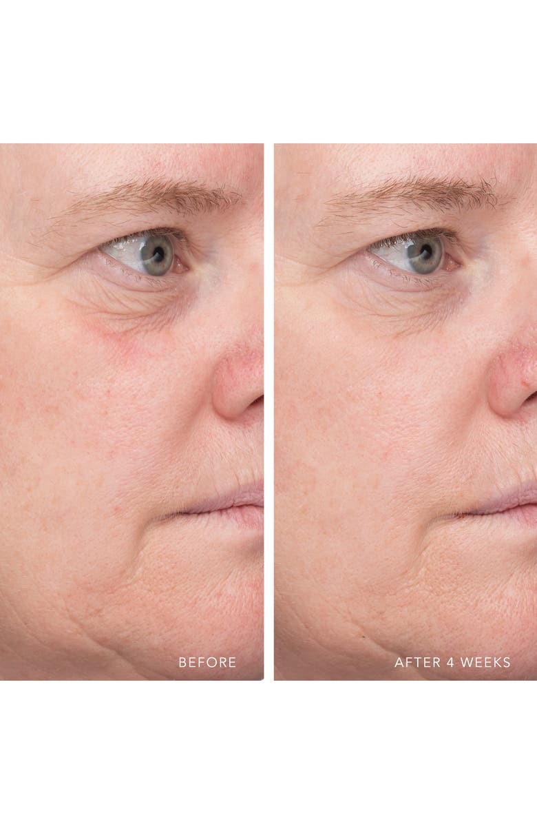 LANCER Skincare Ultra Hydrating Serum with Hyaluronic Complex-7, Alternate, color,