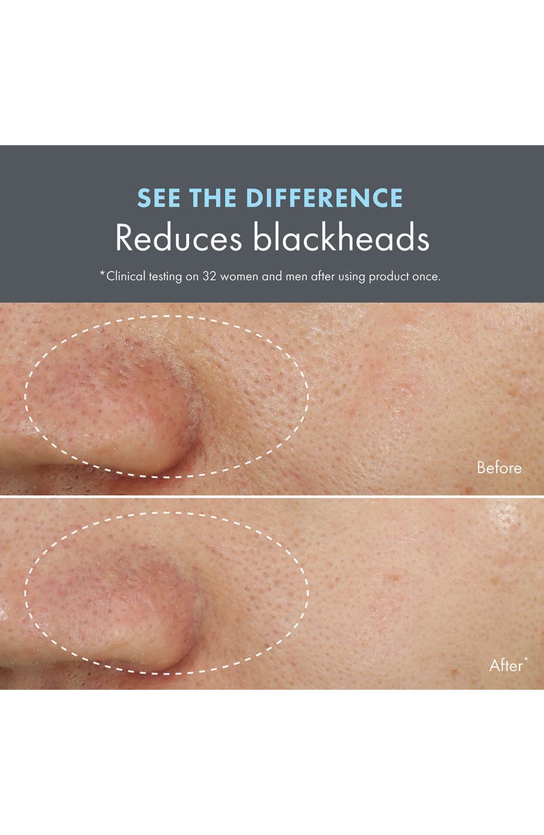 Origins Clear Improvement Blackhead Clearing Mask-to-Scrub, Alternate, color,