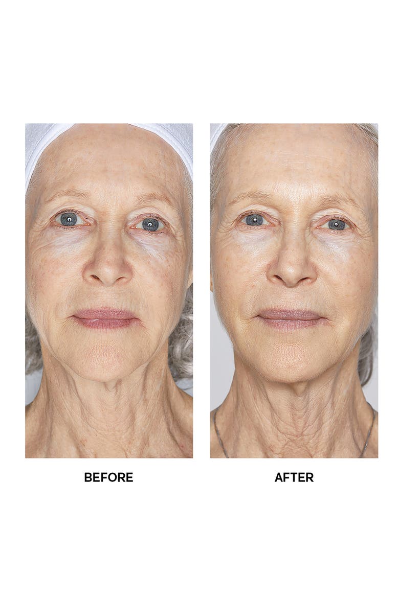 Cell Forte Serum with BIOMSC™ Duo $650 Value, Alternate, color, NO COLOR