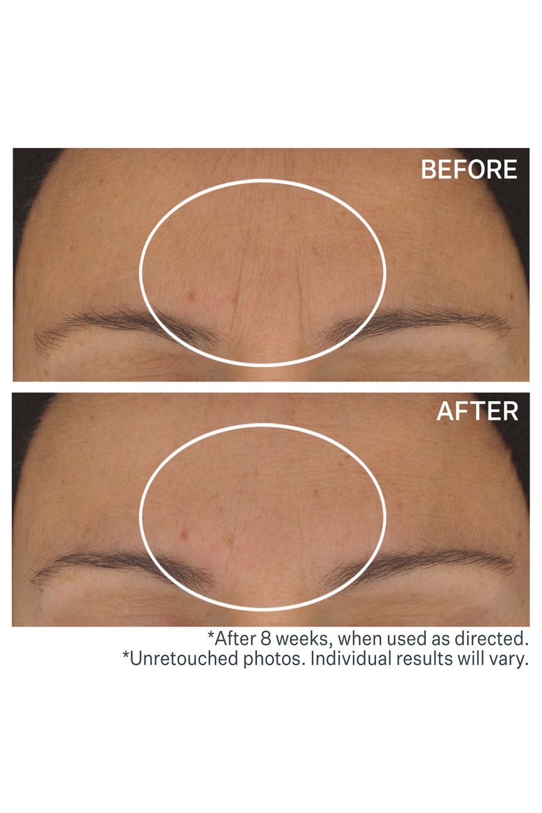 StriVectin STAR.light Retinol Night Oil, Alternate, color, NO COLOR