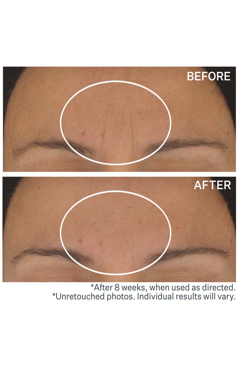 StriVectin<sup>®</sup> StriVectin STAR.light Retinol Night Oil, Alternate, color, 