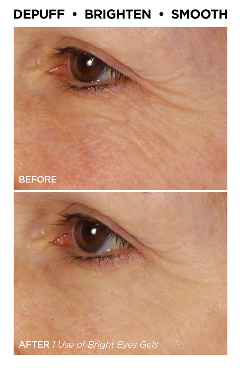 BeautyBio All Eyes On You Bright Eyes Collagen + Colloidal Silver Infused Eye Patches, Alternate, color, 