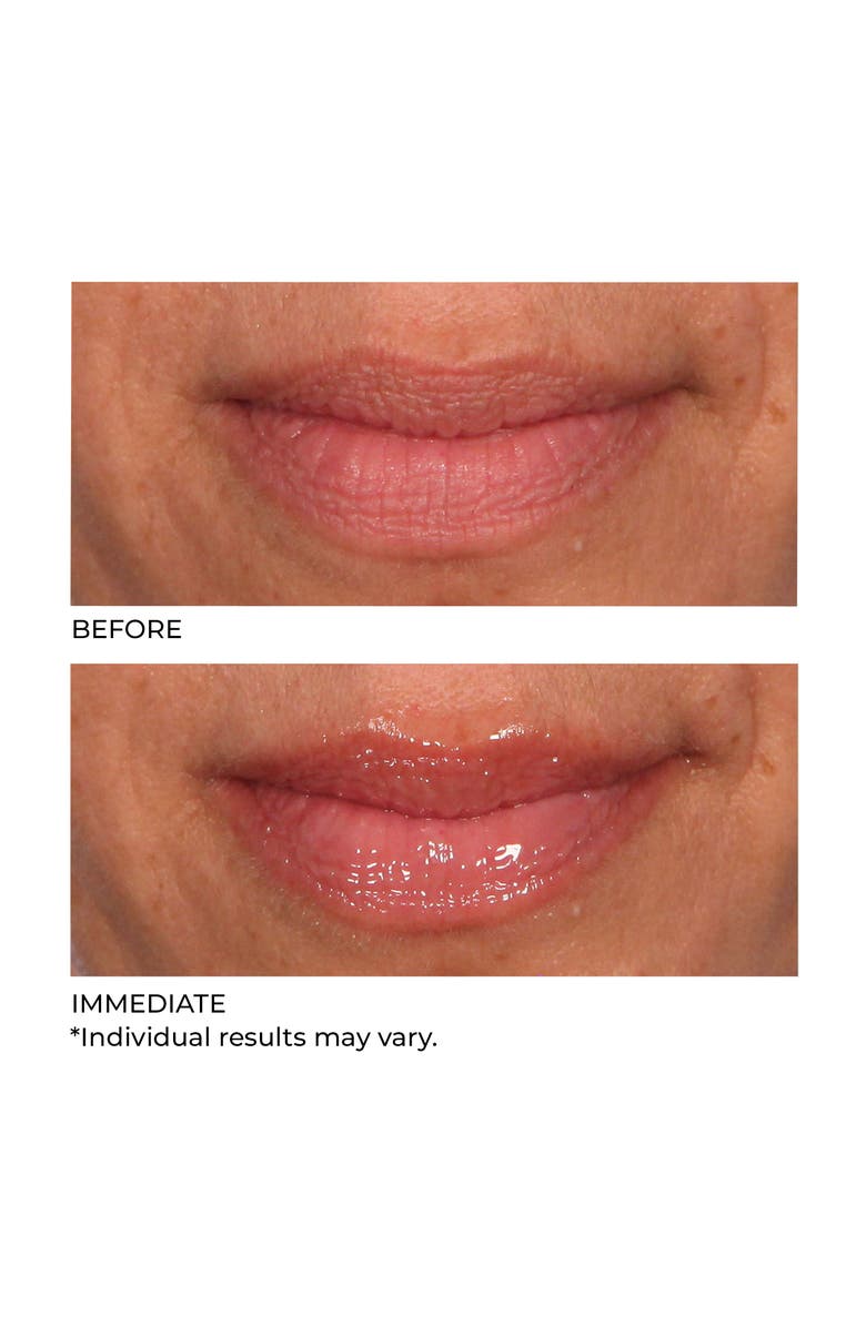 Dr. Nassif Skincare Hydro-Screen for Lips, Alternate, color, Pink Champagne